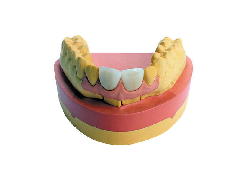 Majesthetik-Gingiva silicone - 8 cartouches de 50 ml
