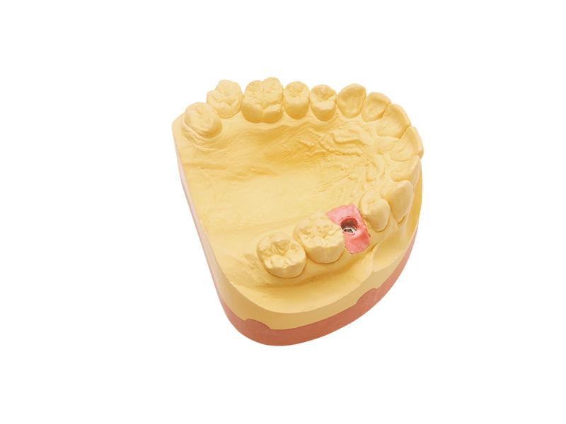 Majesthetik Gingiva-Scan - Coffret