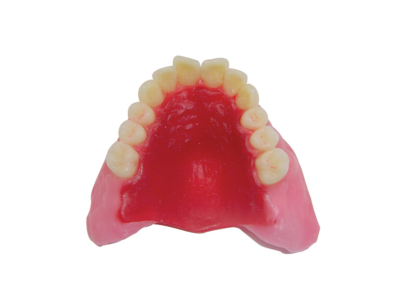 Préformes palatines en cire 1,5 mm - 12 pièces